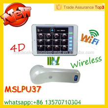 MSLPU37M CE & ISO zugelassenen protable Blasenscanner Wireless Blasensonde